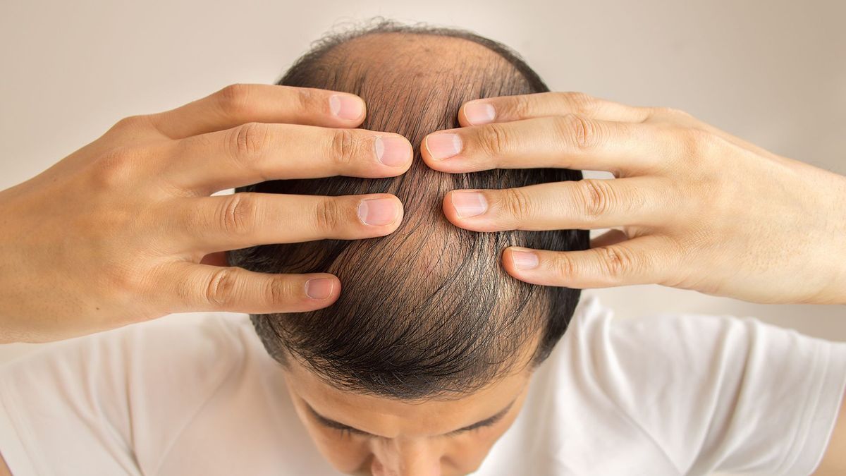 a-new-type-of-microneedle-patch-restored-hair-in-mouse-models