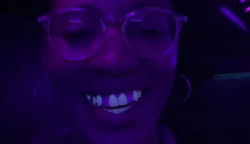 When Dental Implants Hit the Dance Floor: A Nightclub Surprise