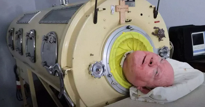 Iron Lung Man: A Life Lived in Breath